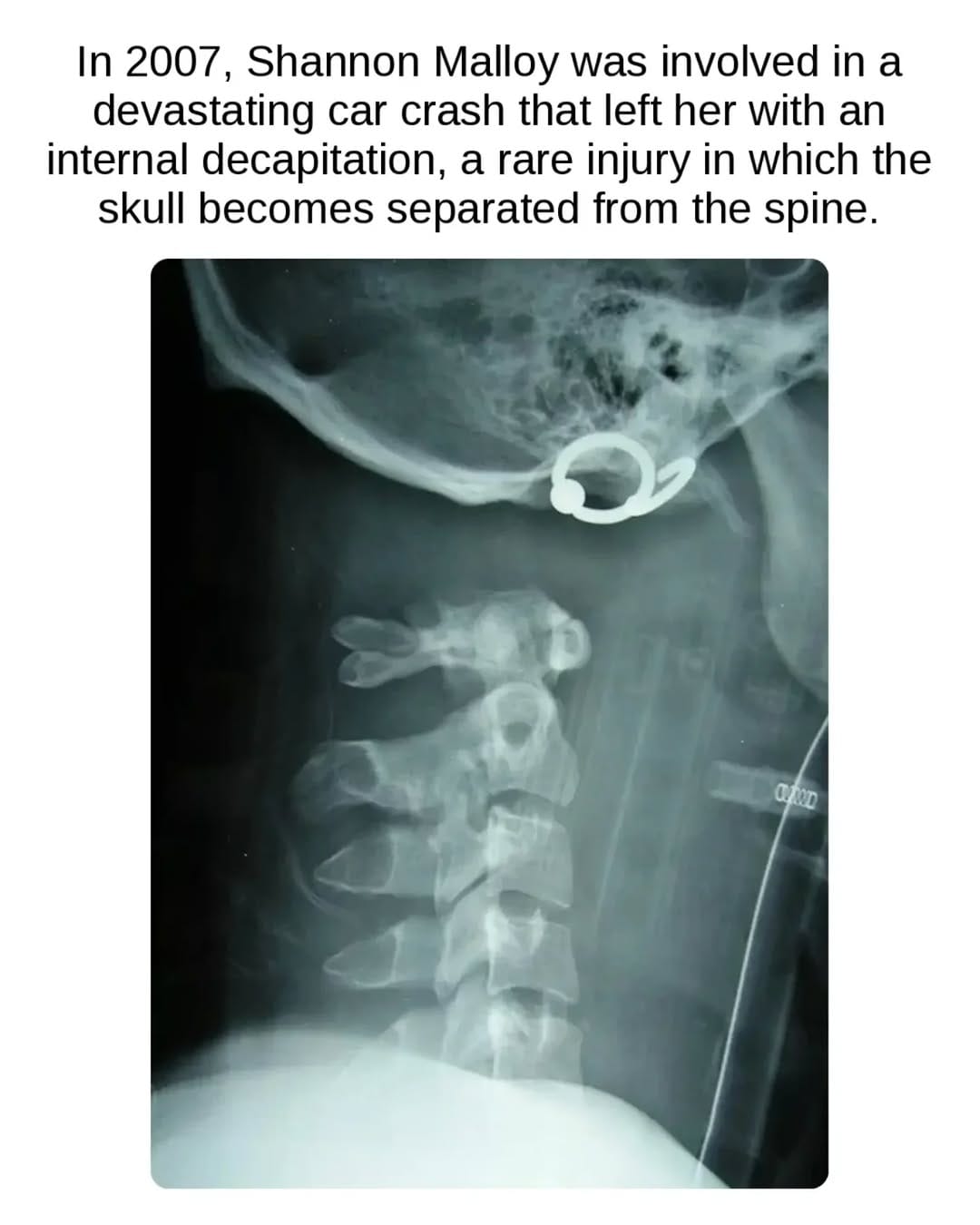 Post 4 by Dr Sidney | Orthopaedic Surgeon on Instagram (image)