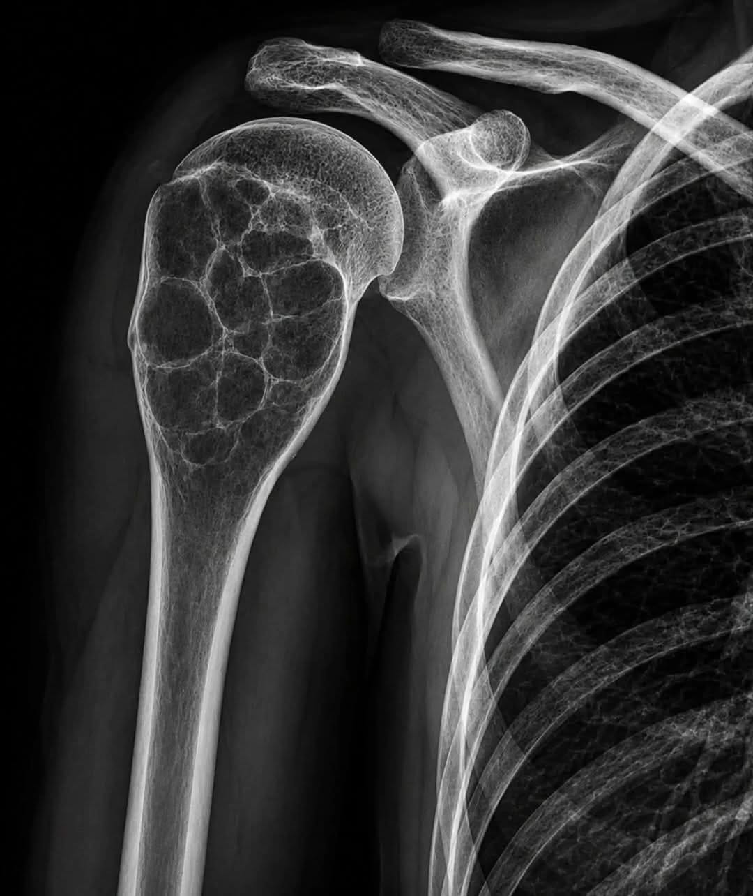 Post 2 by Dr Sidney | Orthopaedic Surgeon on Instagram (image)