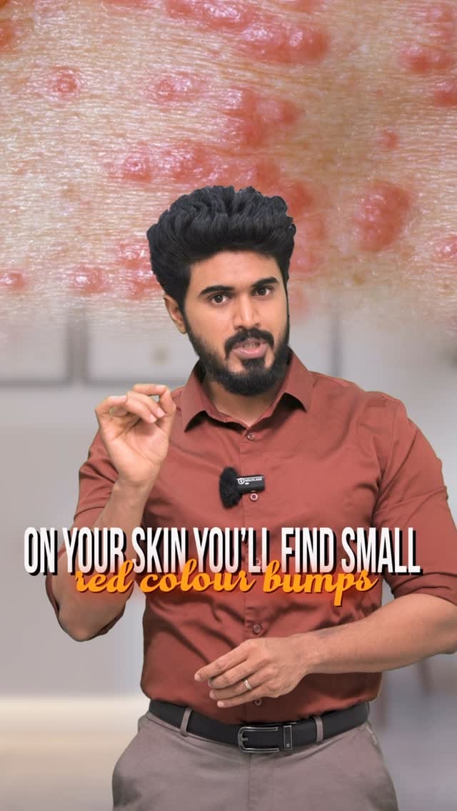 Post 10 by Dr. Harish  MBBS., MD DVL on Instagram (video)