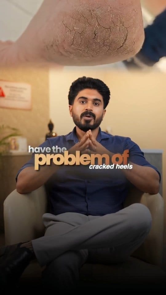 Post 1 by Dr. Harish  MBBS., MD DVL on Instagram (video)