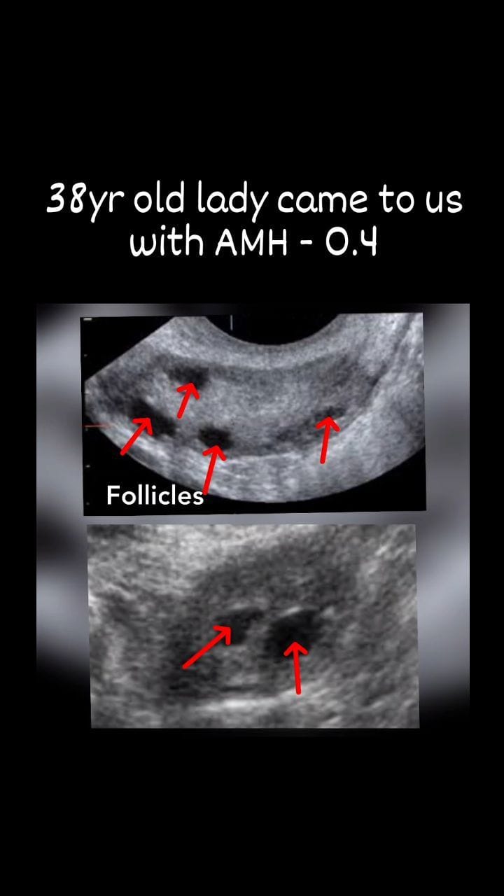 Post 10 by Dr Aradhya Achuri on Instagram (video)