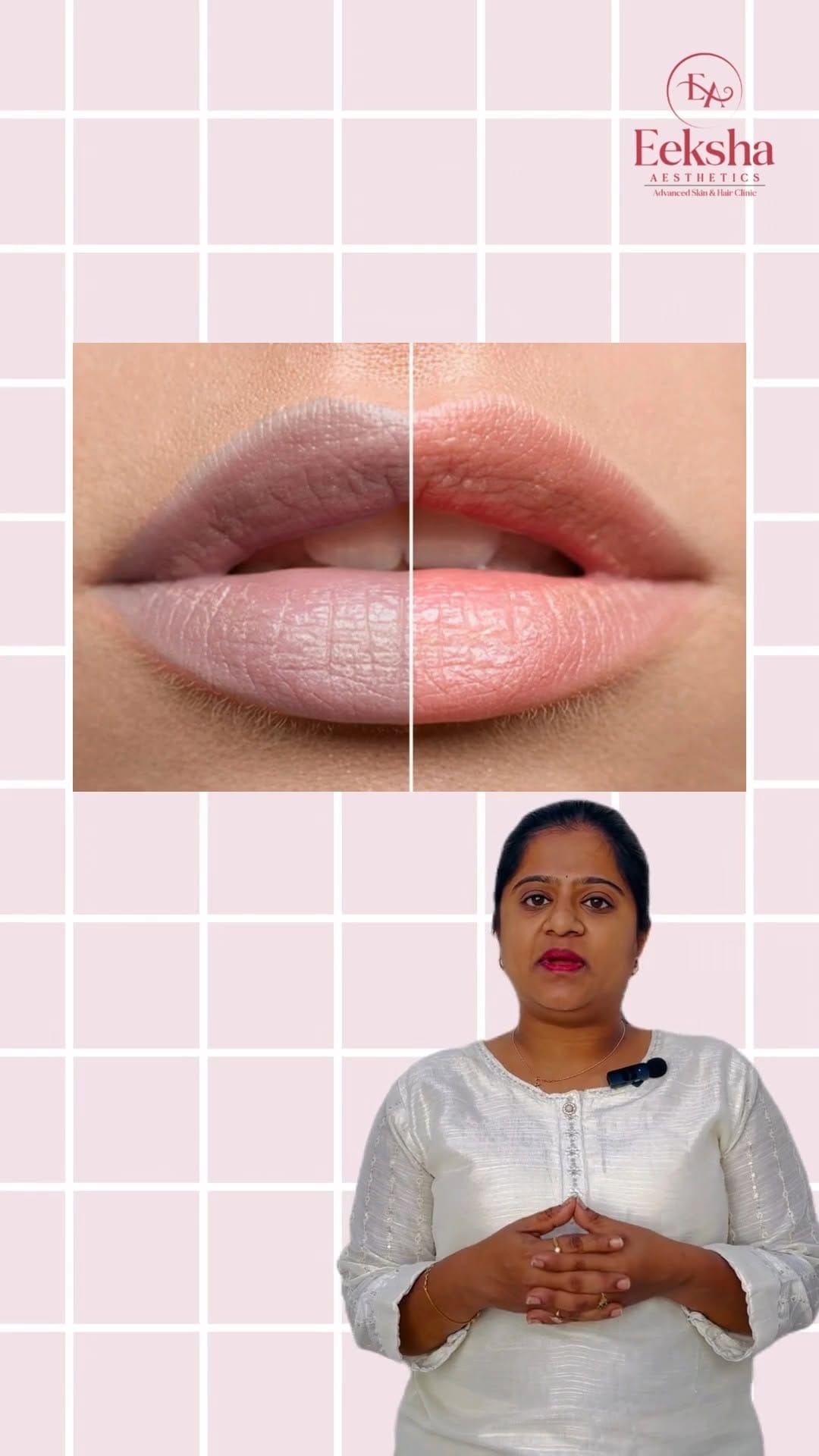 Post 10 by Eeksha Aesthetics | Skin and Hair Clinic on Instagram (video)