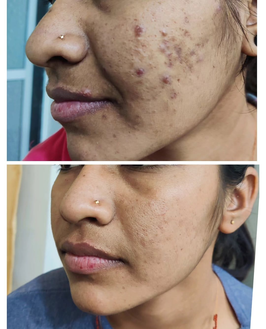 Post 6 by Dr Nidhi patel on Instagram (image)
